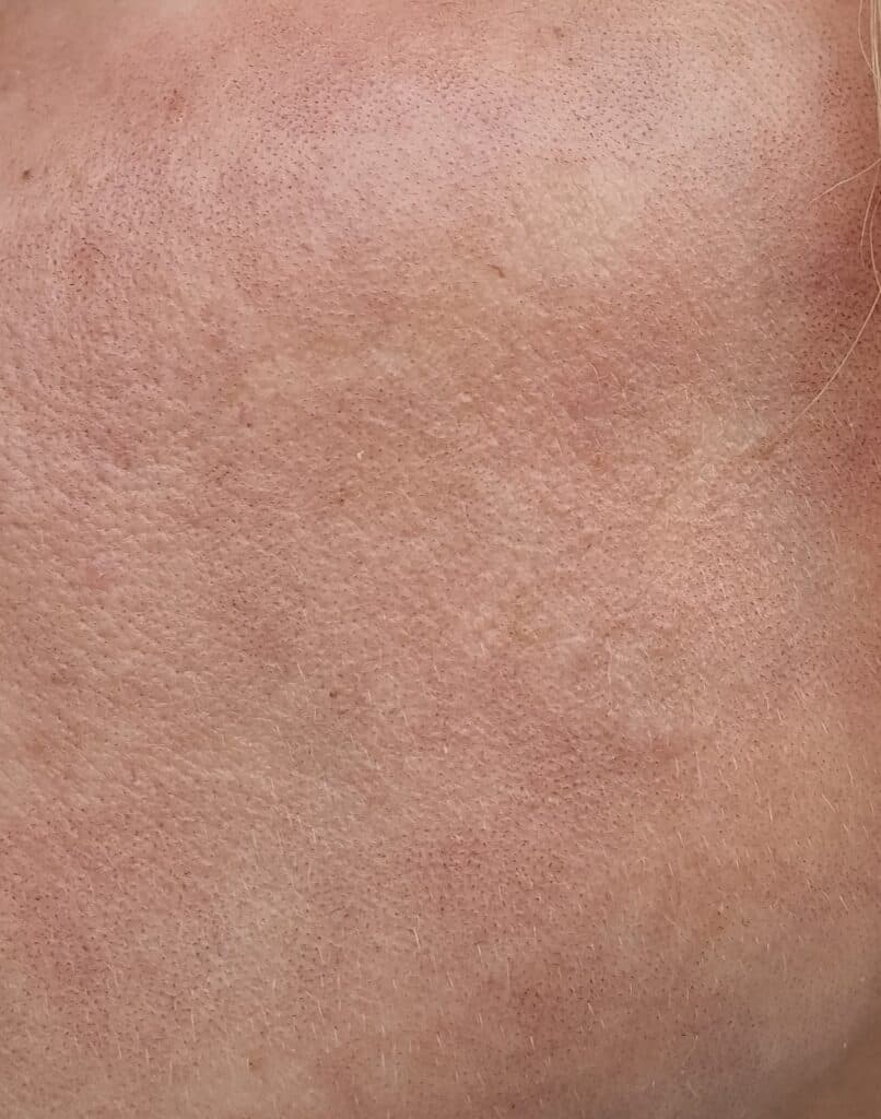 3 den sled ResurFX tochki